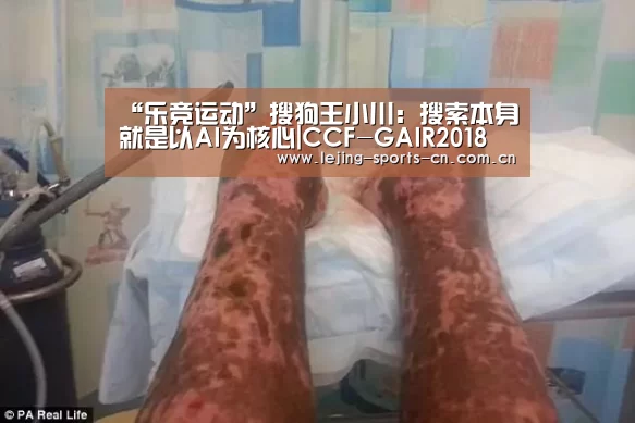 “乐竞运动”搜狗王小川:搜索本身就是以AI为核心|CCF-GAIR2018(图1) 乐竞app